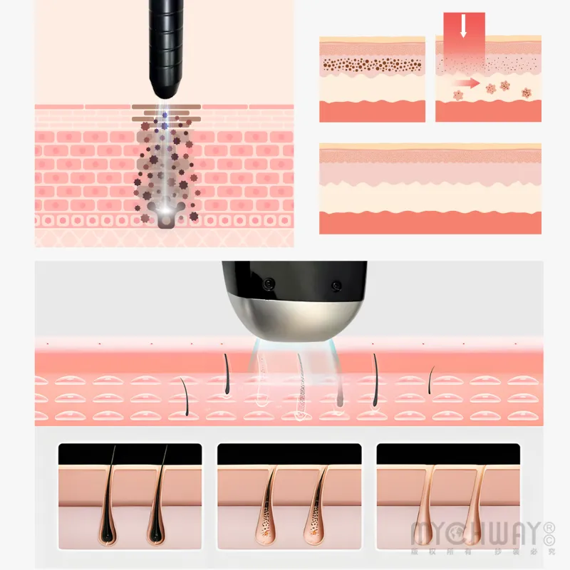 4 In 1 Professional Pico Laser Diode Hair Removal Skin Rejuvenation Machine