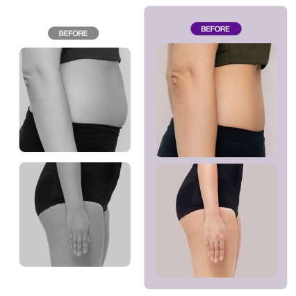 9-in-1 Professional 40k Lipo Cavitation Machin