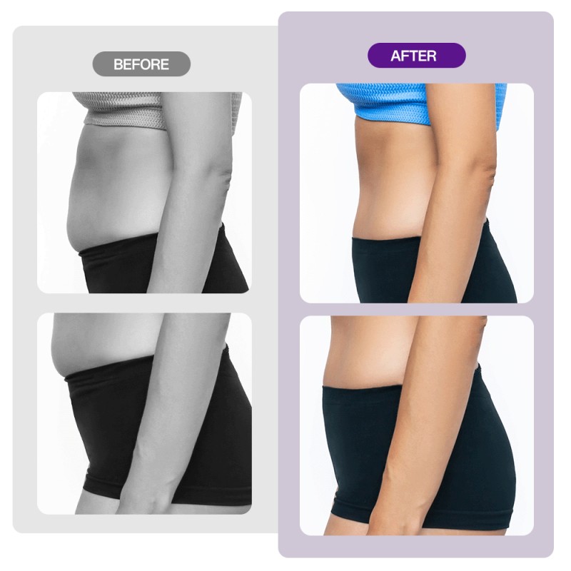 5 In 1 Ultrasonic Cavitation R-F Slimming Fat Loss Anti Cellulite Machine