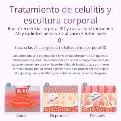 UNOISETION 9IN1 40K Cavitation 2.0 3D Smart RF