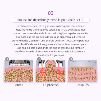 UNOISETION 9IN1 40K Cavitation 2.0 3D Smart RF