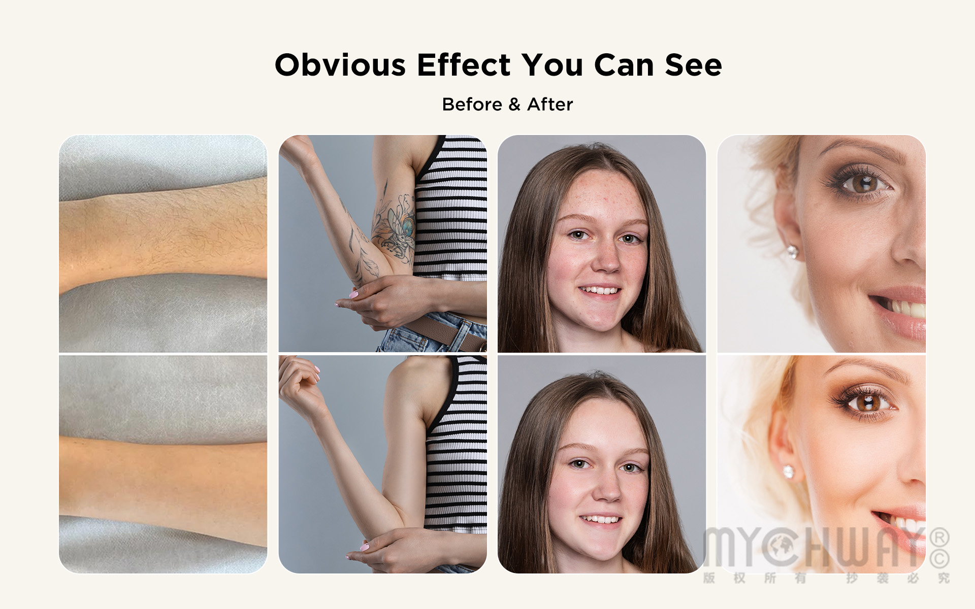 4 In 1 Professional Pico Laser Diode Hair Removal Skin Rejuvenation Machine