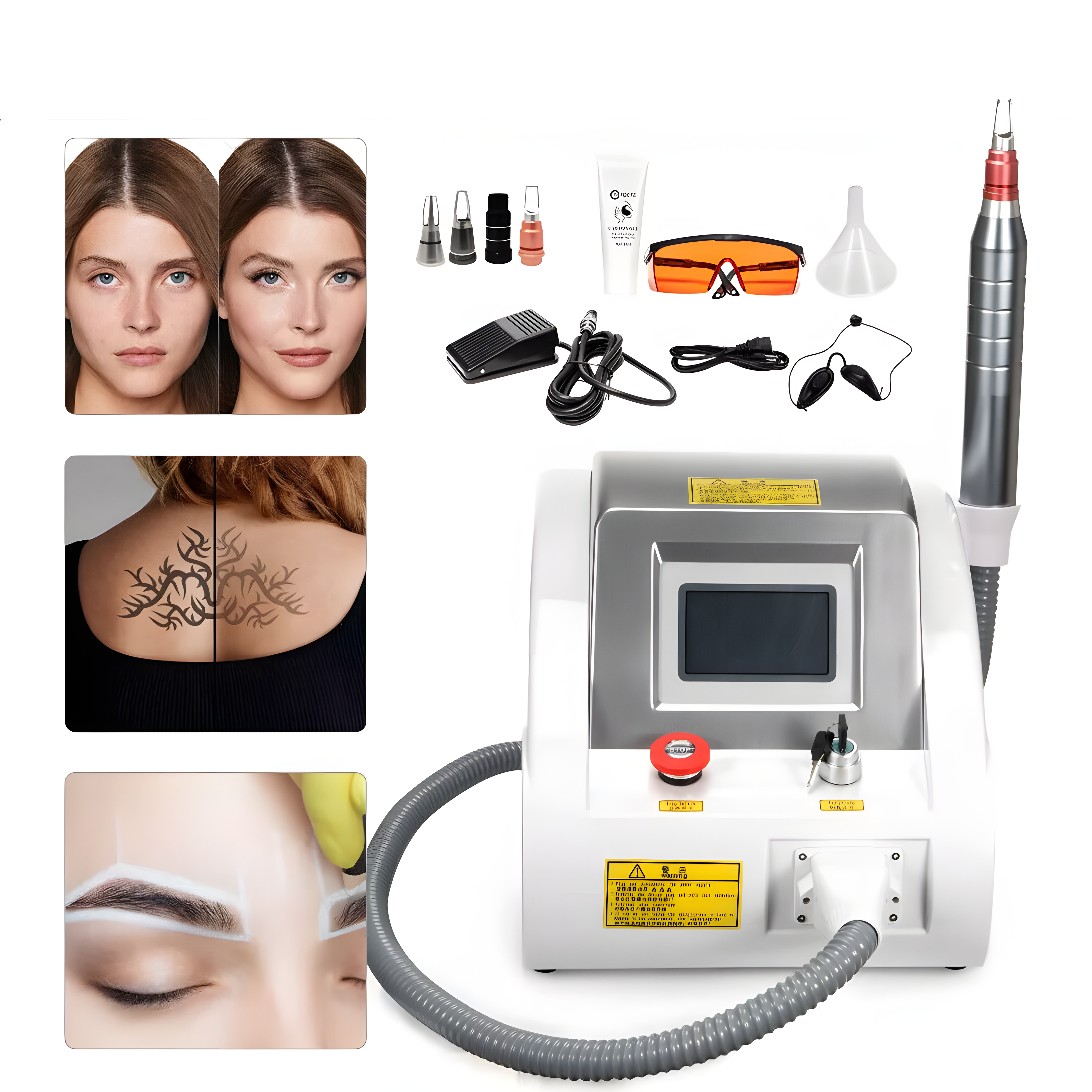 High Power Picosecond Laser Tattoo Removal Machine (Q-Switched Nd:YAG)