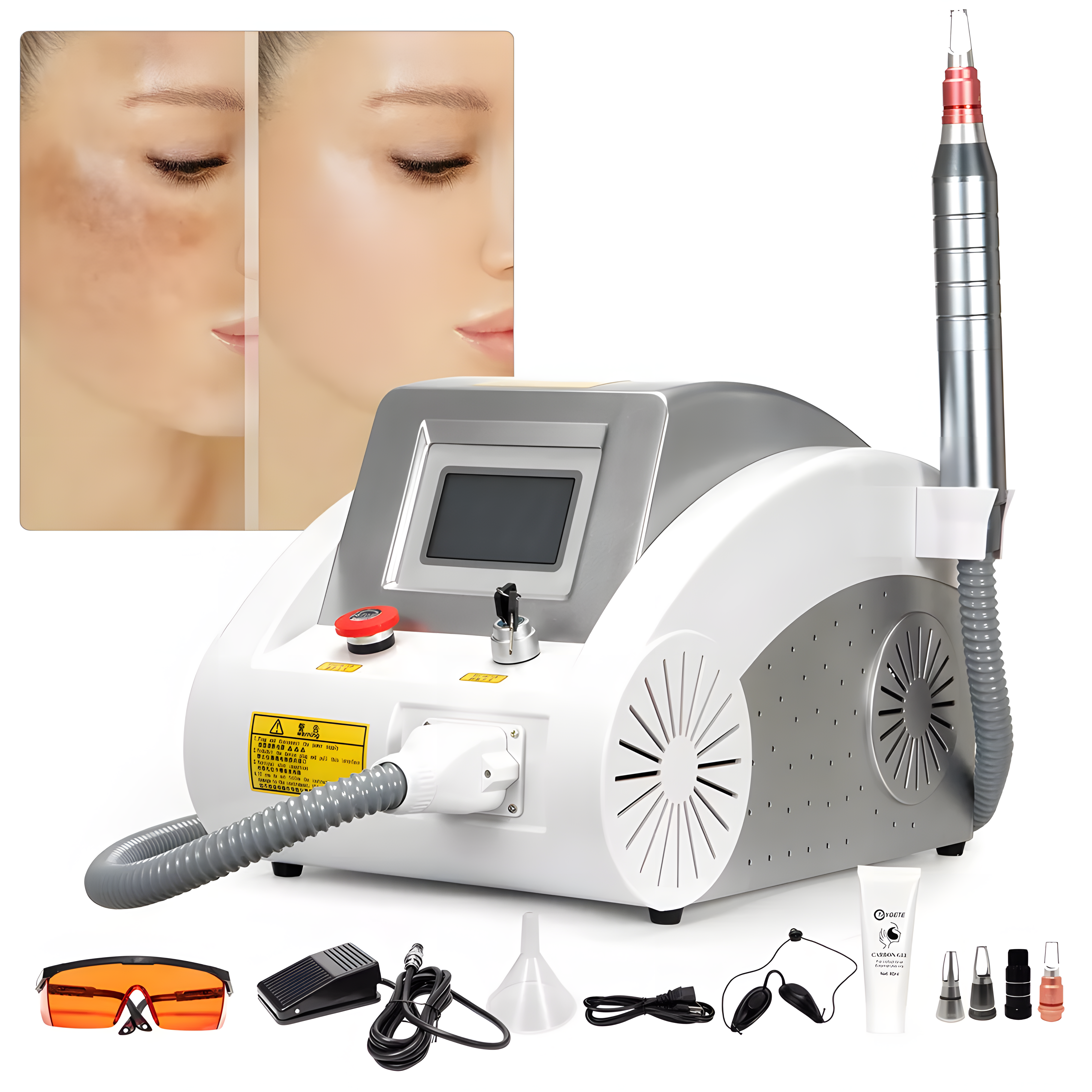 High Power Picosecond Laser Tattoo Removal Machine (Q-Switched Nd:YAG)