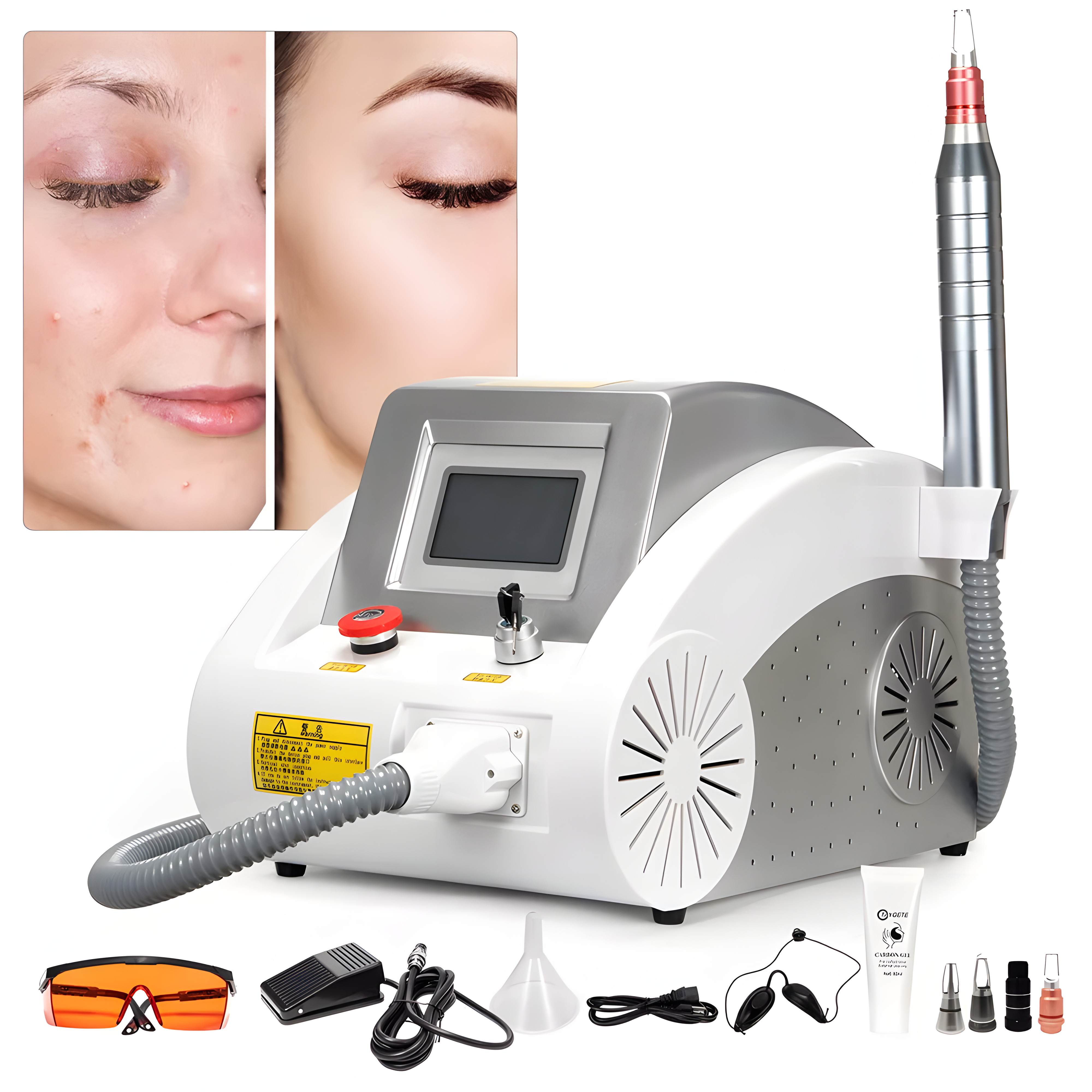 High Power Picosecond Laser Tattoo Removal Machine (Q-Switched Nd:YAG)