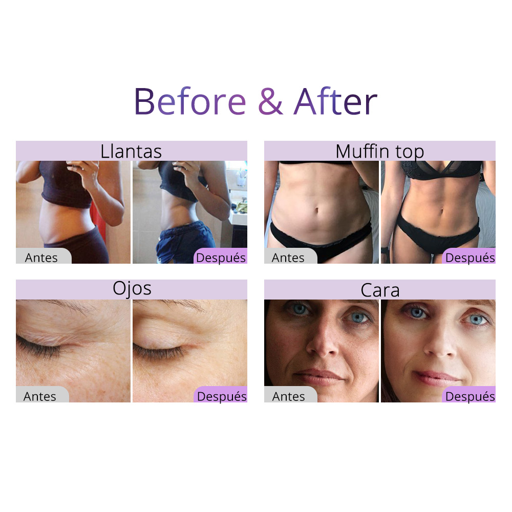 9in1 Aristorm Cavitation Lipo Laser Beauty Equipment