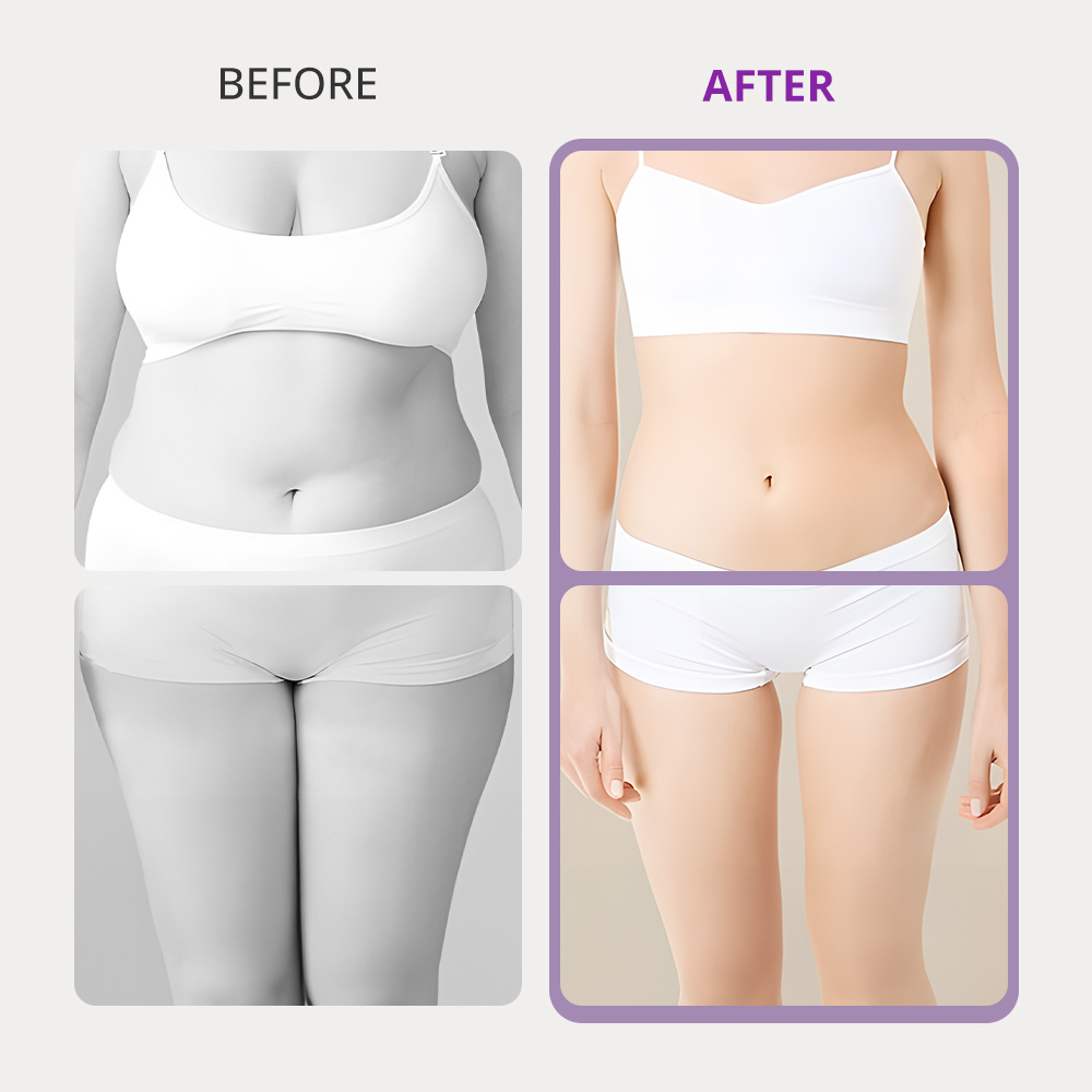 ARISTORM 10IN1 Cavitation RF Machine - myChway US