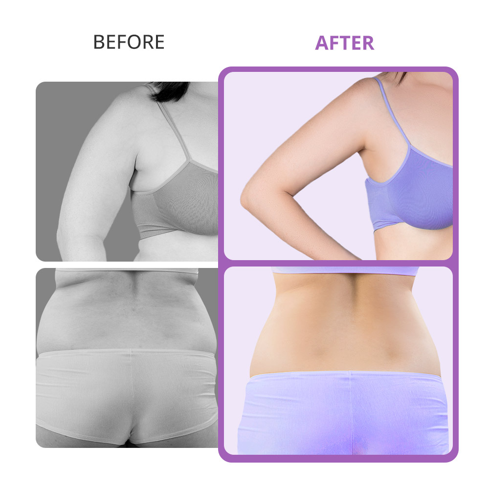 Mini 40k Home Use Ultrasonic Cavitation Machine