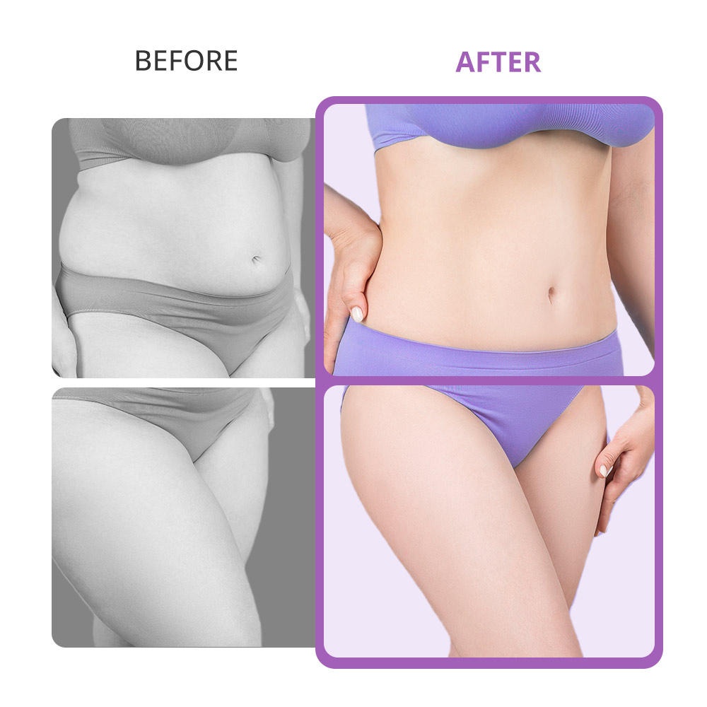 Mini 40k Home Use Ultrasonic Cavitation Machine