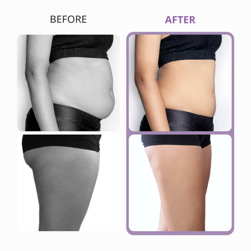 5in1 3D Smart RF 40k Unoisetion Cavitation Fat Burning Machine