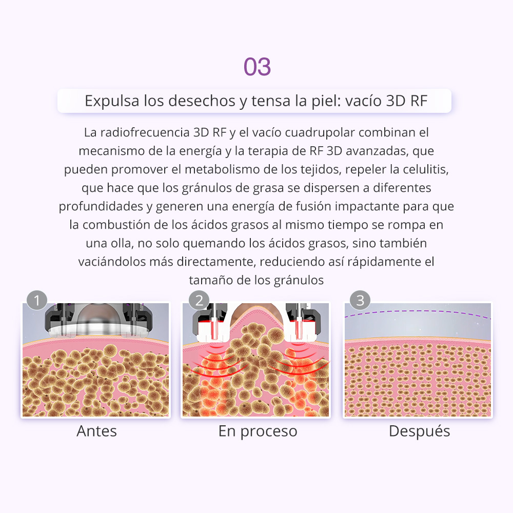 UNOISETION 9IN1 40K Cavitation Machine Body Sculpting RF Facial Skin Care for Home Spa