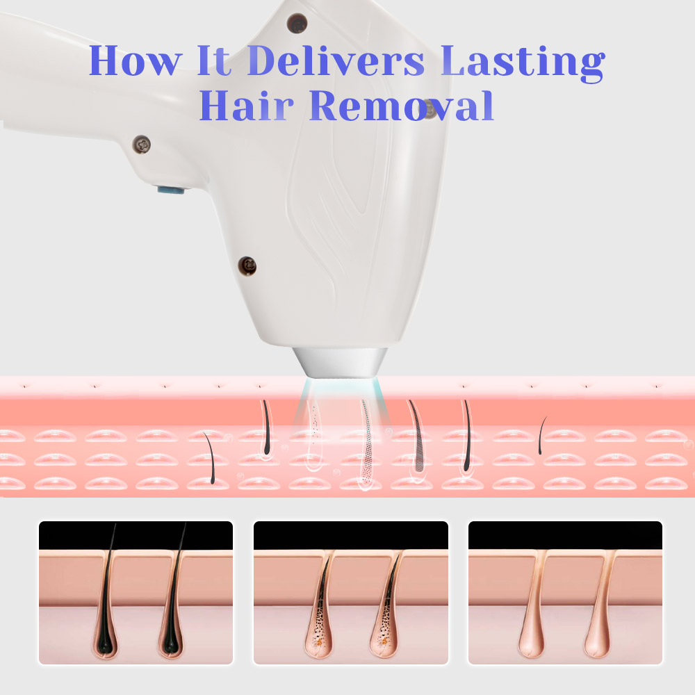 2 In1 DPT 808nm Diode Hair Removal  YAG Laser Tattoo Removal Machine