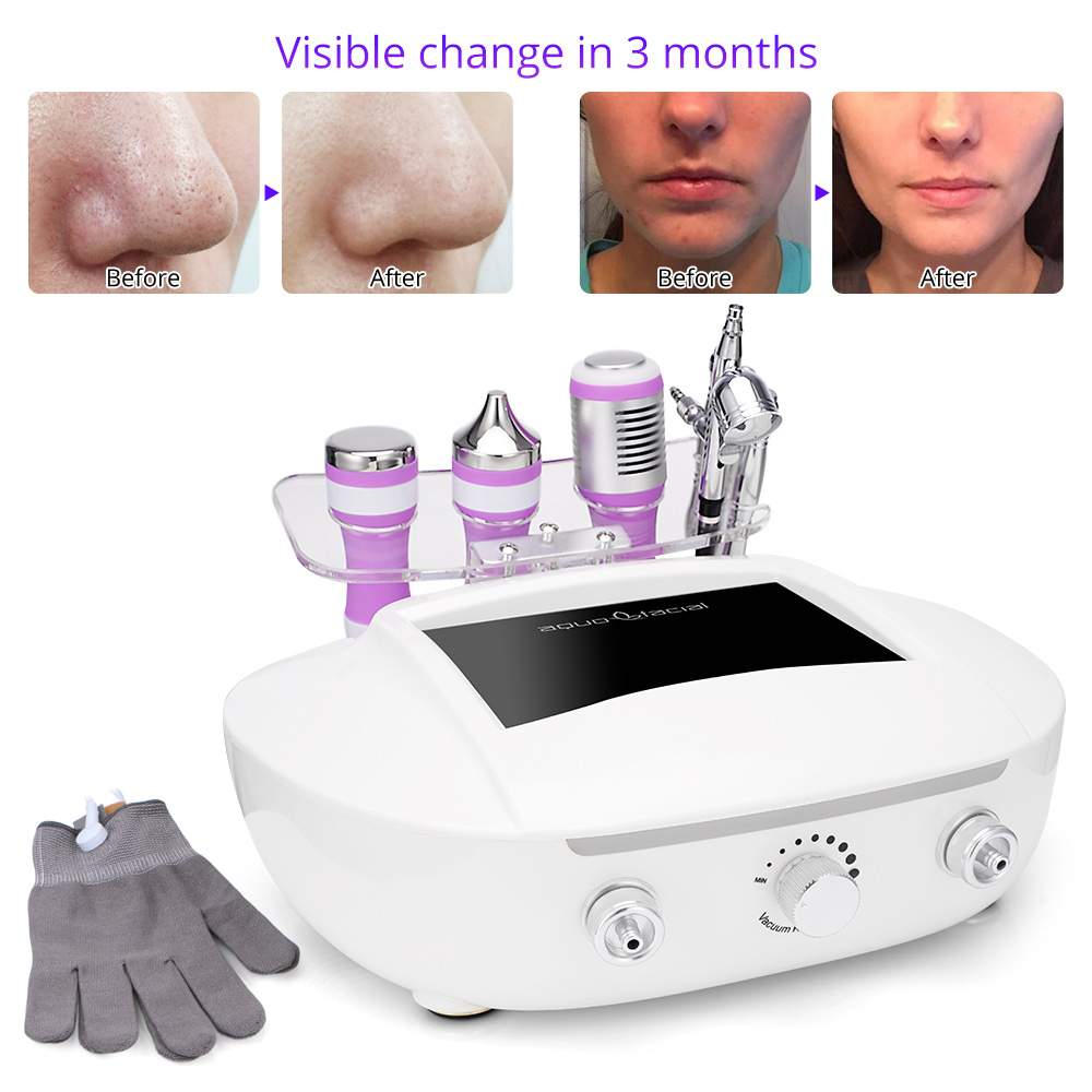Diamond Dermabrasion Oxygen Jet Blackhead Removal - myChway US