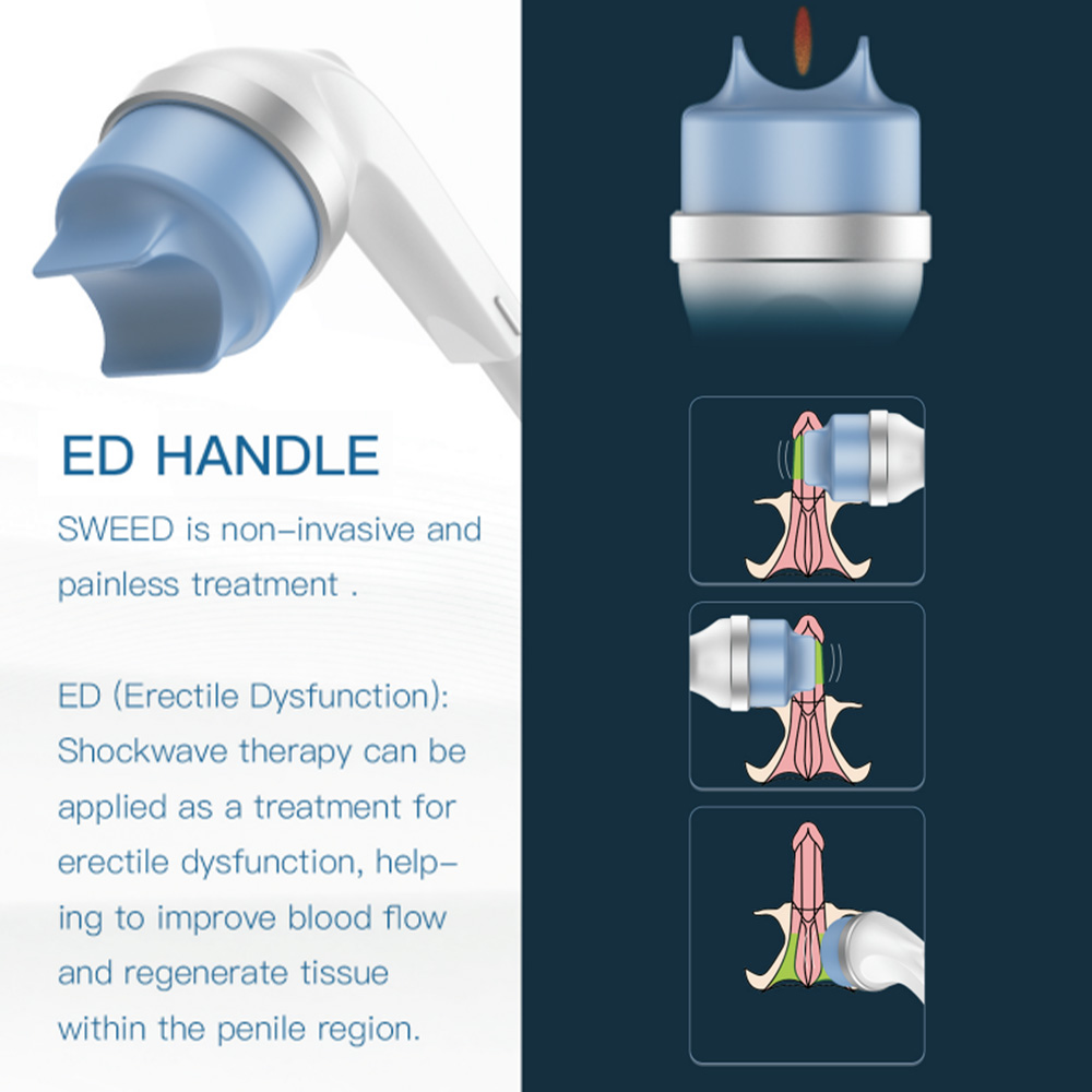 Extracorporeal Shockwave Therapy SW ED Pain Relief Physiotherapy Machine