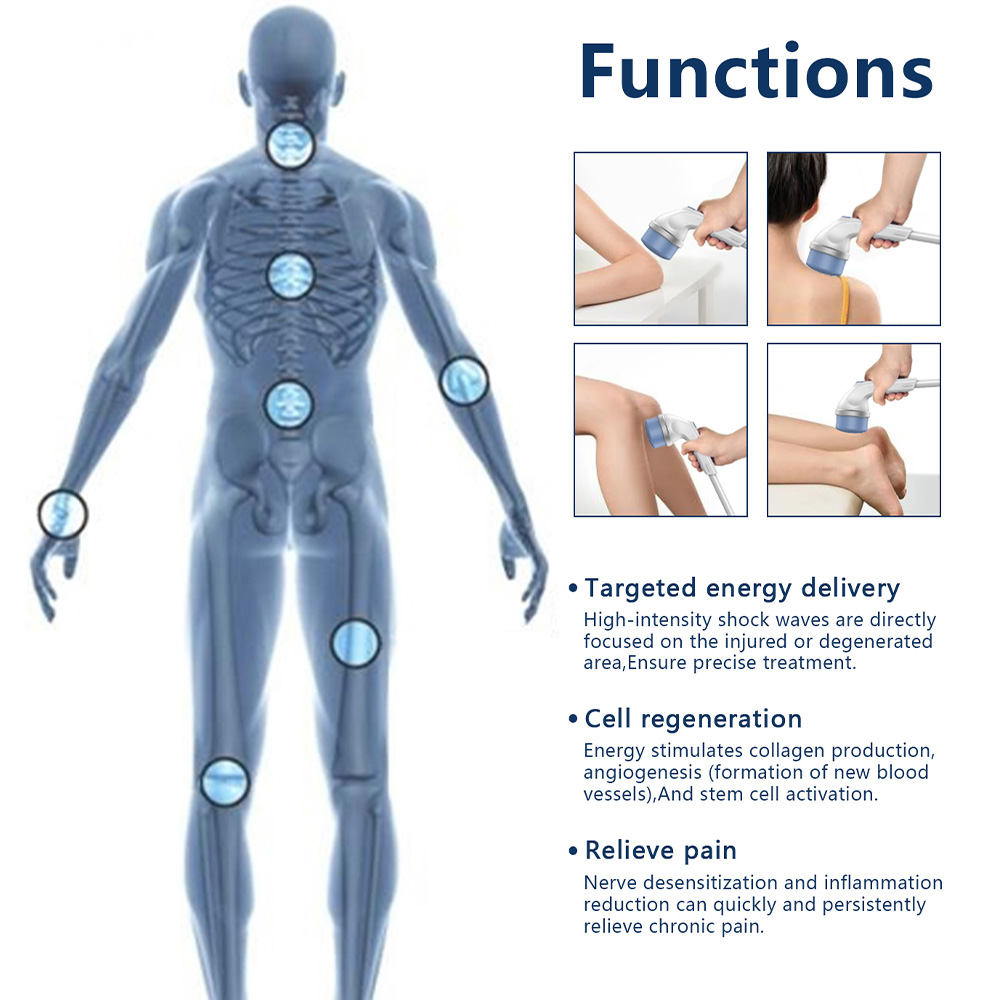 Extracorporeal Shockwave Therapy SW ED Pain Relief Physiotherapy Machine