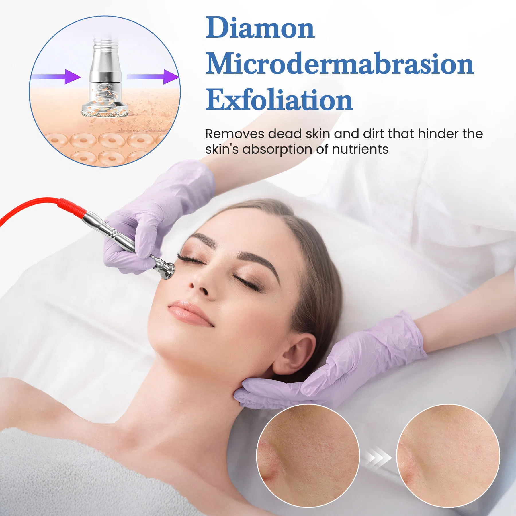Diamond Microdermabrasion Machine 3 In 1 Facial Pores Cleaning And Spray Device